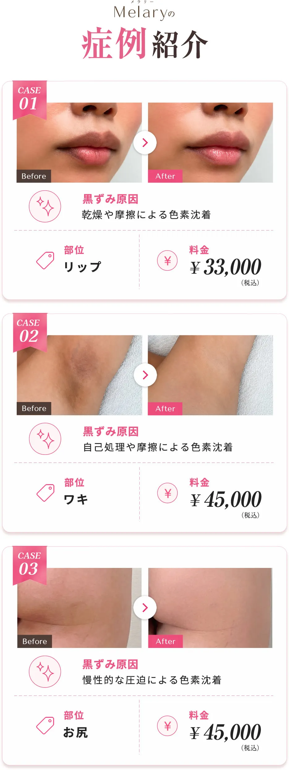 ビフォーアフター